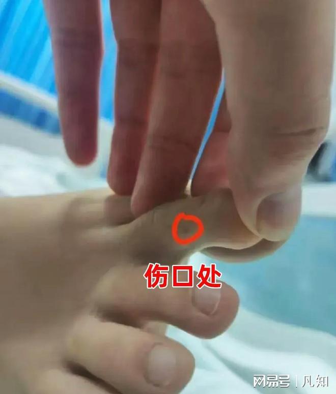 续：生活照曝光家属透露更多细节 通凯发k8登录27岁女孩被蛇咬身亡后(图10)
